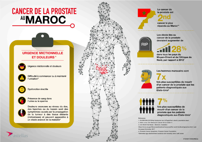 infographie-cancer-prostate